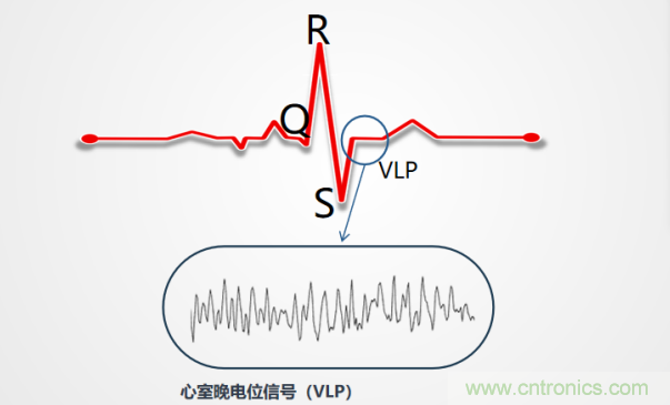 解決心電監(jiān)測行業(yè)難題,曼森伯格的濾波技術獲國家知識產權局發(fā)明授權 解決心電監(jiān)測行業(yè)難題,曼森伯格的濾波技術獲國家知識產權局發(fā)明授權